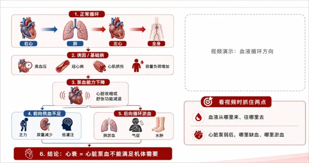 图片展示了心衰的发病机制流程图。从正常循环开始,经诱因/基础病、泵血能力下降、前向供血不足、后向循环淤血,最终得出结论:心衰 = 心脏泵血不能满足机体需要。图中用箭头和文字说明各环节,如右心→肺→左心→全身,高血压、冠心病等诱因,心肌收缩或舒张功能减退等泵血能力下降表现,乏力、尿量减少等前向供血不足症状,肺淤血、气促等后向循环淤血表现。右侧还提示看视频时抓住两点:血液流向及心脏泵弱后哪里缺血、哪里淤血。