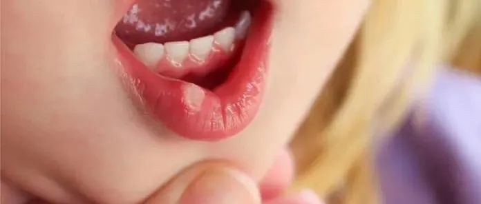 TikTok浏览量超12万！指套款儿童牙刷热卖，亚马逊平台已断货！