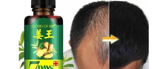 国人品牌跨境生发爆款“姜王”再次立案维权！